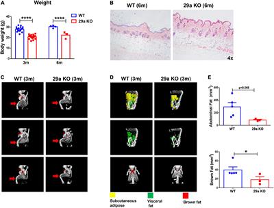 Deficiency of miR-29a/b1 leads to premature aging and dopaminergic neuroprotection in mice